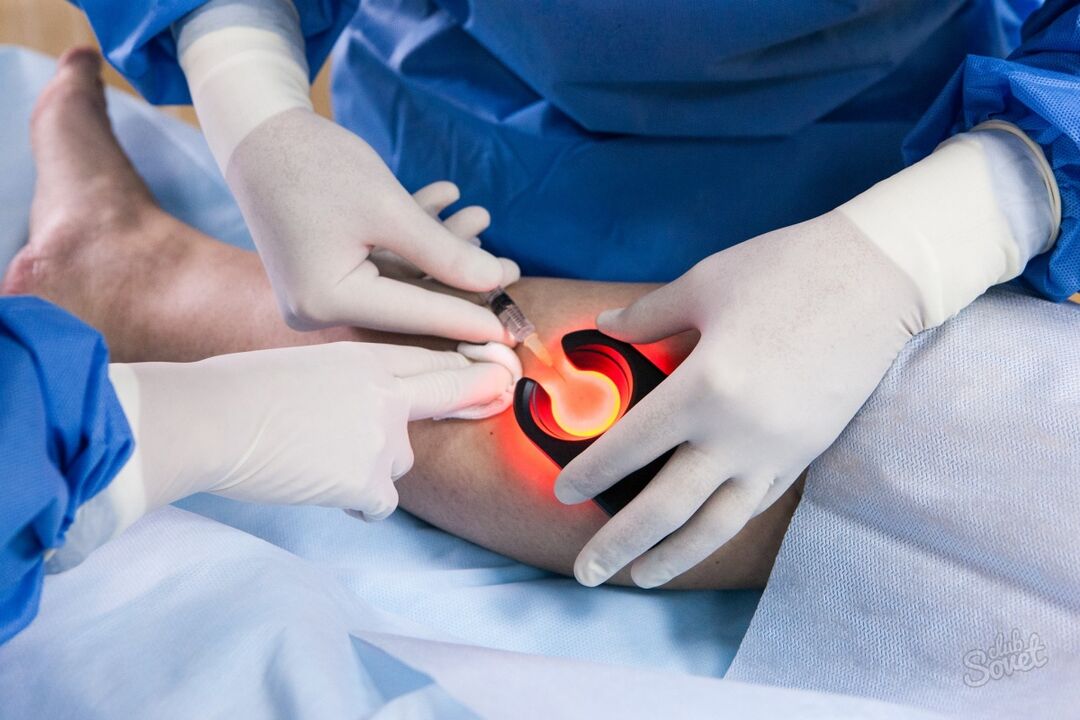 Diagnosis of varicose veins on the legs