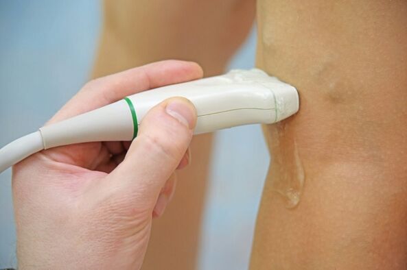 Ultrasound of veins