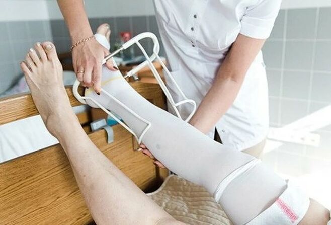 Postoperative surgery from the leg vein